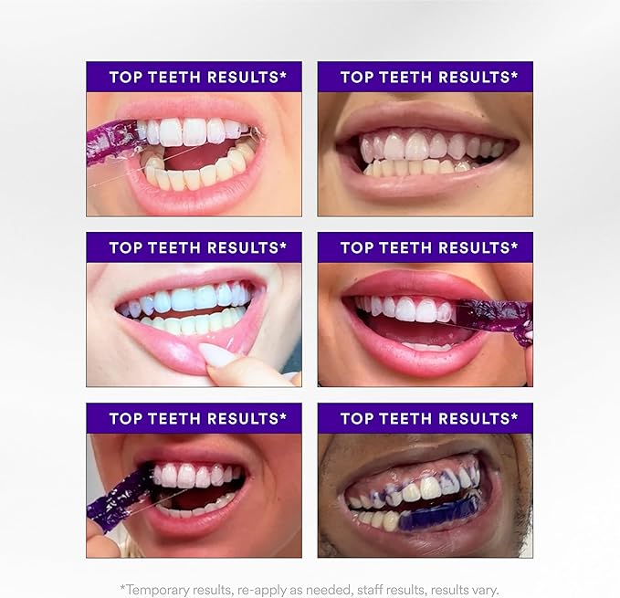 Teeth Whitening Strips 14 Treatments, Enamel Safe for Sensitive Tooth, Whitens Teeth, Purple Whitening Strips, Removes Yellow Stains & Bad Breath - Effective Color Correction for a Brighter Smile